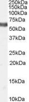 Nuclear Receptor Subfamily 4 Group A Member 1 antibody, PA5-18573, Invitrogen Antibodies, Western Blot image 