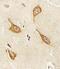 Phosphatidylinositol-5-Phosphate 4-Kinase Type 2 Alpha antibody, PA5-72201, Invitrogen Antibodies, Immunohistochemistry frozen image 