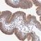 NudC Domain Containing 2 antibody, HPA037384, Atlas Antibodies, Immunohistochemistry paraffin image 