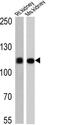 ATPase Na+/K+ Transporting Subunit Alpha 1 antibody, MA3-929, Invitrogen Antibodies, Western Blot image 