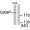 Minichromosome Maintenance Complex Component 3 Associated Protein antibody, A05445, Boster Biological Technology, Western Blot image 