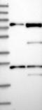 Protein Phosphatase With EF-Hand Domain 1 antibody, NBP1-87239, Novus Biologicals, Western Blot image 