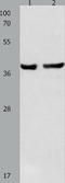 Serpin Family B Member 5 antibody, TA322980, Origene, Western Blot image 