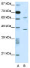 TRNA Methyltransferase 1 Like antibody, TA329119, Origene, Western Blot image 