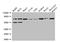 Collagen Type VIII Alpha 1 Chain antibody, LS-C396429, Lifespan Biosciences, Western Blot image 