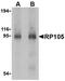 CD180 Molecule antibody, NBP1-76705, Novus Biologicals, Western Blot image 