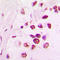 ETS Variant 6 antibody, LS-C352175, Lifespan Biosciences, Immunohistochemistry paraffin image 