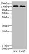 Tripeptidyl Peptidase 2 antibody, LS-C676627, Lifespan Biosciences, Western Blot image 