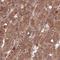 Erb-B2 Receptor Tyrosine Kinase 3 antibody, HPA045396, Atlas Antibodies, Immunohistochemistry frozen image 