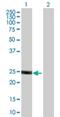 Unc-51 Like Kinase 3 antibody, H00025989-B01P, Novus Biologicals, Western Blot image 