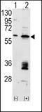 Hdm2 antibody, TA302211, Origene, Western Blot image 