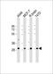 Acyl-CoA Binding Domain Containing 4 antibody, MBS9216999, MyBioSource, Western Blot image 