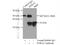 HtrA Serine Peptidase 2 antibody, 15775-1-AP, Proteintech Group, Immunoprecipitation image 