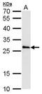 Catechol-O-Methyltransferase antibody, PA5-77920, Invitrogen Antibodies, Western Blot image 