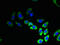 Transmembrane Protein 53 antibody, CSB-PA023853LA01HU, Cusabio, Immunofluorescence image 
