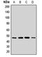 Acylglycerol Kinase antibody, LS-C668791, Lifespan Biosciences, Western Blot image 