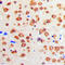 Insulin Like Growth Factor 1 Receptor antibody, LS-C352356, Lifespan Biosciences, Immunohistochemistry frozen image 