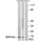 Mitochondrial Pyruvate Carrier 1 antibody, A07721, Boster Biological Technology, Western Blot image 