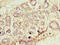 Proliferation-Associated 2G4 antibody, CSB-PA891987LA01HU, Cusabio, Immunohistochemistry paraffin image 