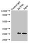 Dynactin Subunit 6 antibody, LS-C675627, Lifespan Biosciences, Immunoprecipitation image 