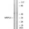 Mitochondrial Ribosomal Protein L4 antibody, A14430, Boster Biological Technology, Western Blot image 