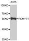 Protein Kinase, Membrane Associated Tyrosine/Threonine 1 antibody, MBS128786, MyBioSource, Western Blot image 