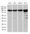 Importin subunit beta-1 antibody, M01851-1, Boster Biological Technology, Western Blot image 