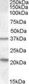 Tumor Suppressor Candidate 3 antibody, GTX88807, GeneTex, Western Blot image 