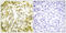 DNA Topoisomerase II Alpha antibody, LS-C117993, Lifespan Biosciences, Immunohistochemistry paraffin image 
