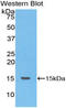 Nknb antibody, LS-C295584, Lifespan Biosciences, Western Blot image 