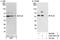 Decapping MRNA 2 antibody, A302-597A, Bethyl Labs, Immunoprecipitation image 