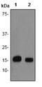 Baculoviral IAP Repeat Containing 5 antibody, ab76424, Abcam, Western Blot image 