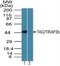 Toll Like Receptor Adaptor Molecule 2 antibody, NBP2-24686, Novus Biologicals, Western Blot image 