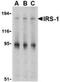 Insulin Receptor Substrate 1 antibody, NBP1-77216, Novus Biologicals, Western Blot image 