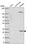 Scm Polycomb Group Protein Like 1 antibody, HPA061397, Atlas Antibodies, Western Blot image 