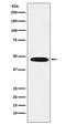 Gamma-Aminobutyric Acid Type A Receptor Beta1 Subunit antibody, M04752, Boster Biological Technology, Western Blot image 