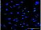 Zinc Finger Protein 100 antibody, H00163227-M01-100ug, Novus Biologicals, Immunofluorescence image 