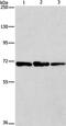Phenylalanyl-TRNA Synthetase Subunit Beta antibody, PA5-50334, Invitrogen Antibodies, Western Blot image 