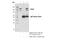 Signal Transducer And Activator Of Transcription 2 antibody, 72604S, Cell Signaling Technology, Immunoprecipitation image 