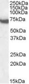 DEAD-Box Helicase 5 antibody, EB06310, Everest Biotech, Western Blot image 