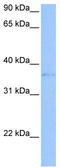 TREML2 antibody, TA338680, Origene, Western Blot image 