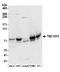 TBC1 Domain Family Member 15 antibody, A304-588A, Bethyl Labs, Western Blot image 