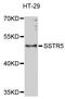 Somatostatin Receptor 5 antibody, MBS128105, MyBioSource, Western Blot image 