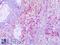 C-X3-C Motif Chemokine Receptor 1 antibody, LS-A86, Lifespan Biosciences, Immunohistochemistry paraffin image 