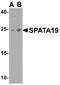 Spermatogenesis Associated 19 antibody, A14636, Boster Biological Technology, Western Blot image 