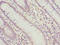 Polo Like Kinase 1 antibody, A63146-100, Epigentek, Immunohistochemistry paraffin image 