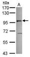 Vezatin, Adherens Junctions Transmembrane Protein antibody, PA5-30651, Invitrogen Antibodies, Western Blot image 