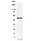 Fli-1 Proto-Oncogene, ETS Transcription Factor antibody, R31300, NSJ Bioreagents, Western Blot image 