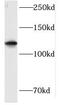 Huntingtin Interacting Protein 1 Related antibody, FNab03869, FineTest, Western Blot image 