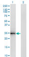 Cell Death Inducing DFFA Like Effector B antibody, LS-C133723, Lifespan Biosciences, Western Blot image 